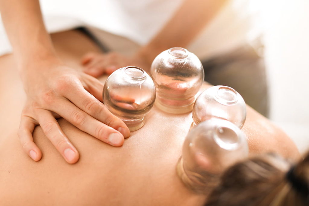 Massage ventouse cupping Isabelle Rabache